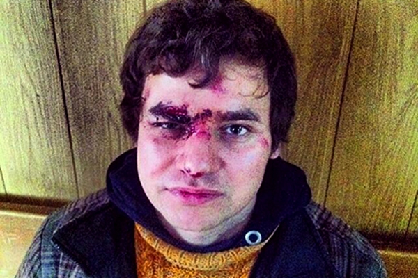 «Беркут» заставил избитого журналиста стоять на коленях в снегу