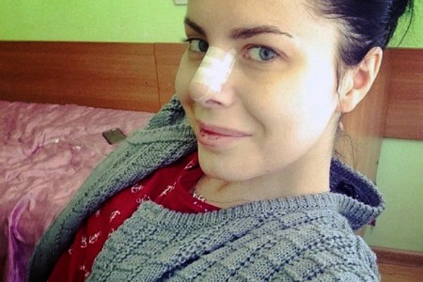 «Спасибушечка» Алена Лоран снова подрихтовала себе лицо (ФОТО)