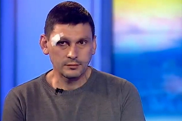 Журналист «Интера» рассказал, кто и как избивал его в Крыму (ВИДЕО)